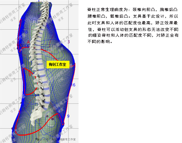 机主侧弯保守治疗培训班