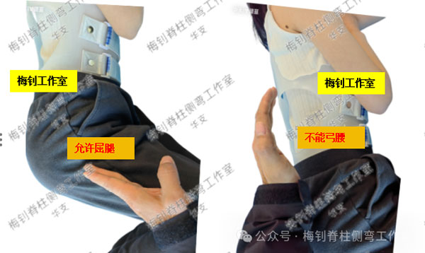 脊柱侧弯保守治疗培训班