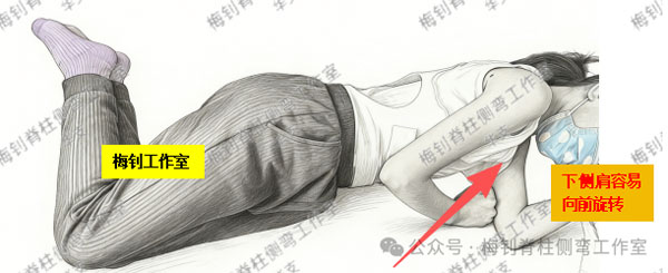 脊柱侧弯保守治疗培训班