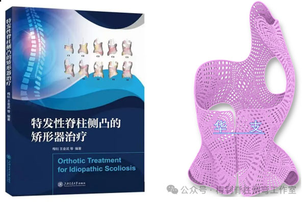 特发性脊柱侧凸矫形器治疗教材与华支矫形器